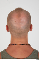  Photos Dylan Parker bald head 0005.jpg